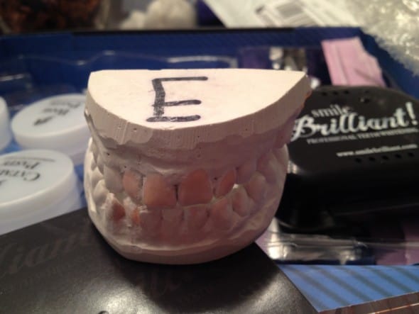 smilebrilliant molds