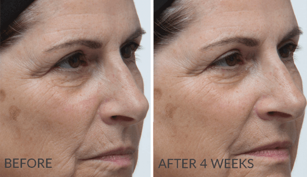 Farmacy Invincible Root Cell AntiAging Serum